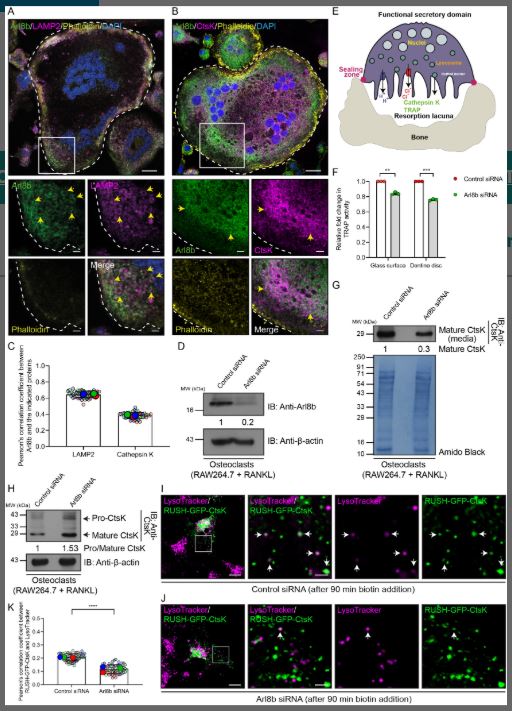 ASCBiology's tweet photo. Recently published in MBoC

Researchers identified an Arl8b–RUFY4–HOPS pathway that controls lysosome maturation and positioning in osteoclasts, revealing how these cells coordinate bone resorption.

https://t.co/n5GCPxLb3G https://t.co/nIuGvbeM5Y