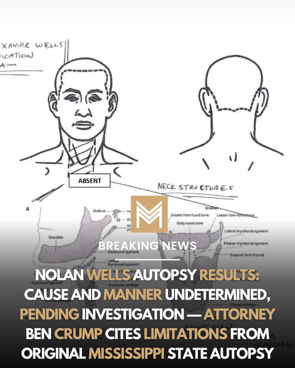 LeeMerrittesq's tweet photo. BREAKING: The state removed his throat before the family could get a second opinion.

Nolan Wells’ independent autopsy results: cause and manner of death undetermined, pending investigation. Attorney Ben Crump says the pathologist couldn’t examine Wells’ lungs or stomach because his throat structures and other organs had already been removed and dissected during the original Mississippi State autopsy.

The report also found significant red discoloration in the soft tissue at the back of Wells’ head and behind his ears.
This family deserves answers immediately.

The fight is not over. It has only just begun.

Justice for Nolan Wells

🎥: @NewsNation @attorneycrump