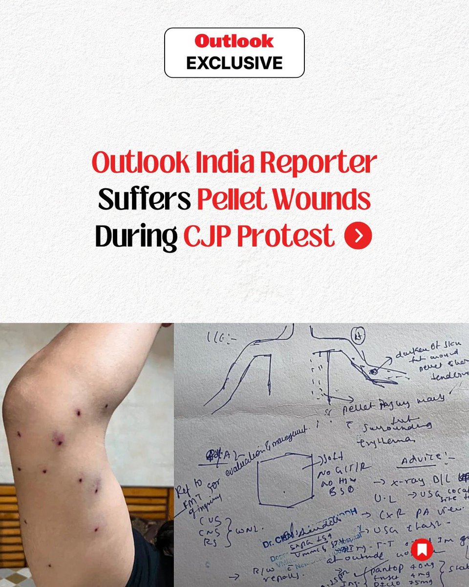 zoo_bear's tweet photo. An @Outlookindia reporter says he was struck by what he believes was a pellet-firing weapon while covering the "Sansad Chalo" protest in Delhi. https://t.co/Ie5F3gALJ2