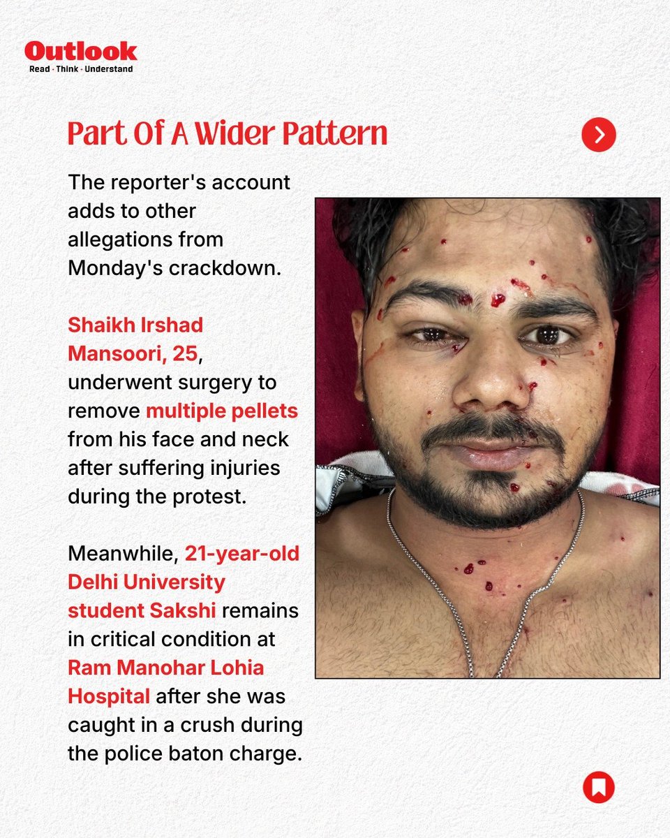 zoo_bear's tweet photo. An @Outlookindia reporter says he was struck by what he believes was a pellet-firing weapon while covering the "Sansad Chalo" protest in Delhi. https://t.co/Ie5F3gALJ2