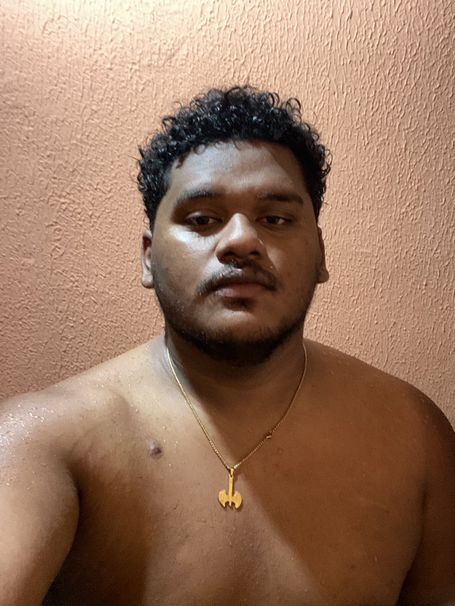 0lhonogato's tweet photo. meu cabelo ta exatamente como era antes de eu ficar careca e isso é lindo https://t.co/IpgprwB6oO