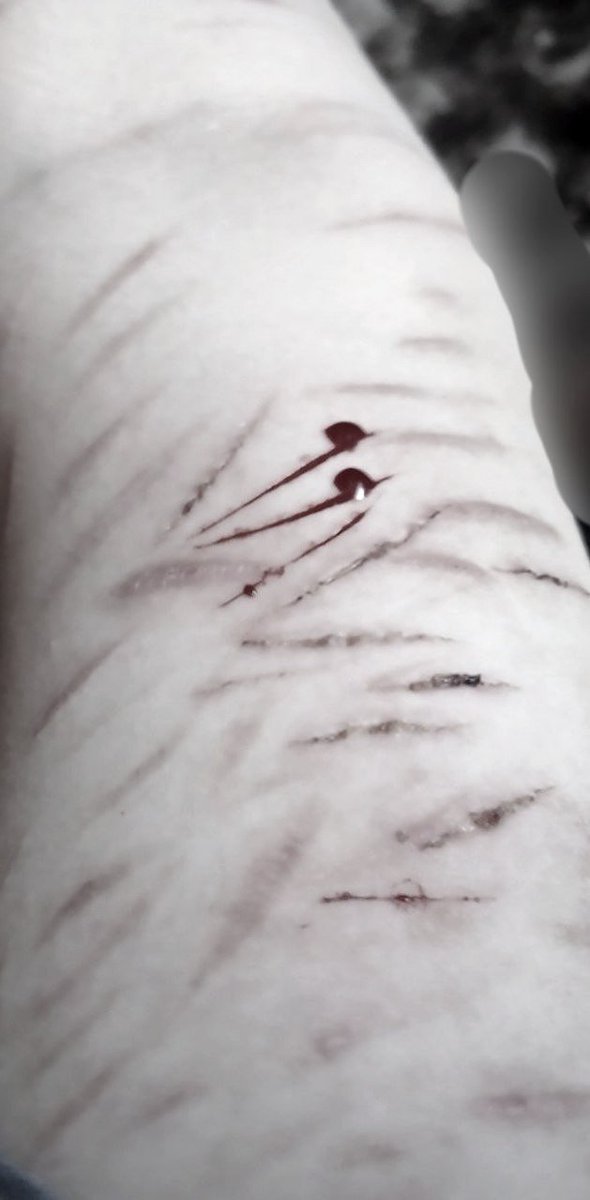 Hoddiex23's tweet photo. SFX MAKEUP THIS IS MAKEUP !!! NOT REAL.

can this be considered a hobby or not

#body #hand #fakeblood https://t.co/x5FiNj8pLE