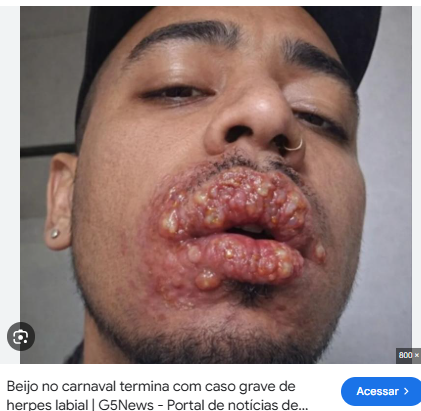 rafaelsna3000's tweet photo. @corleoneYC O dia seguinte.... https://t.co/TyJA4KrAYC