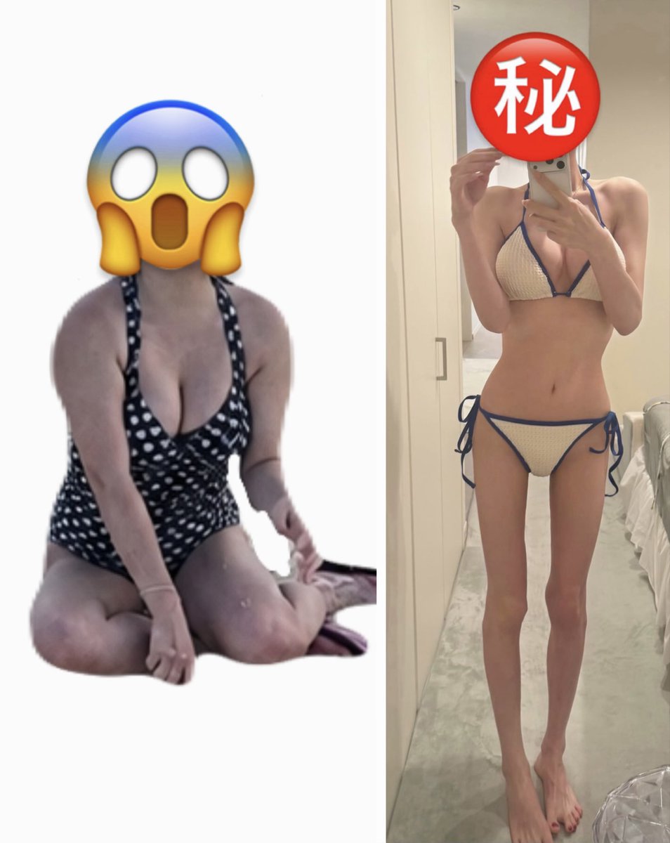 myo_update's tweet photo. 骨ストとか関係なく規定外のデブだった私のダイエットのビフォアフ、本当に人に勇気与えられると思う☺️マンジャロも使ってないし脂肪吸引もしてないし夜職でないし摂食障害でもありません、努力の結果 https://t.co/b9QzGpjDai