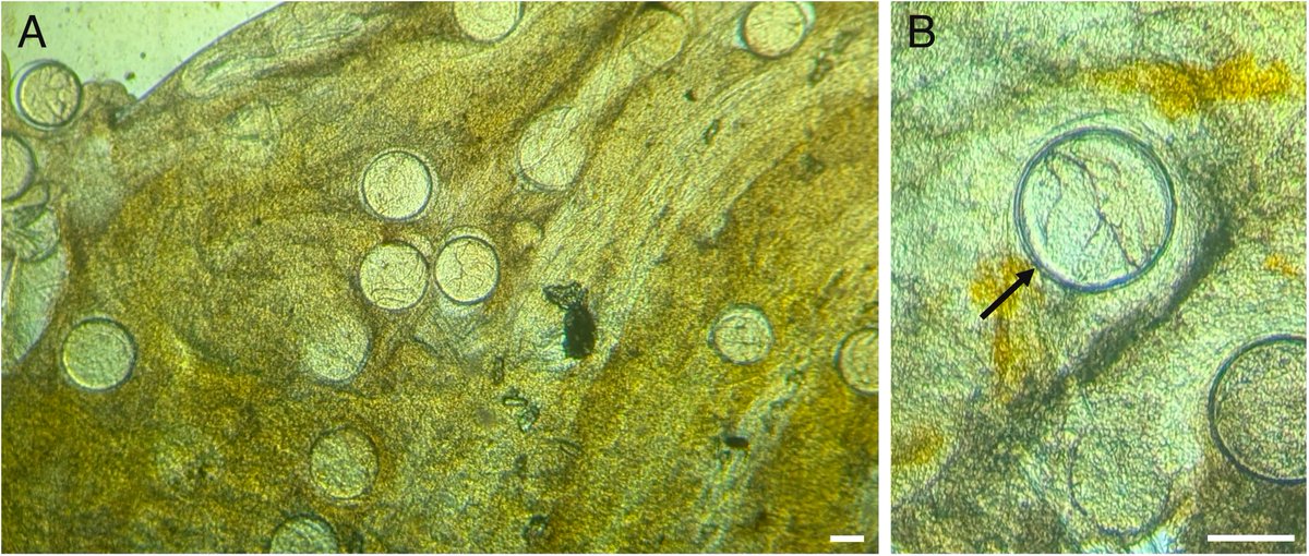 JHelminthology's tweet photo. Maritrema gratiosum is a fluke which uses periwinkles as its first intermediate host, and barnacles as second intermediate host. It is globally distributed, and this study reports on its occurrence in barnacles along the southern coast of British Columbia
https://t.co/yDTHWdpoDM https://t.co/cab8A0JnCG