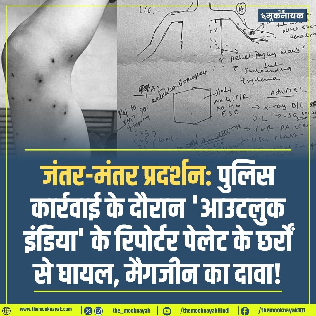 The_Mooknayak's tweet photo. जंतर-मंतर प्रदर्शन: पुलिस कार्रवाई के दौरान 'आउटलुक इंडिया' के रिपोर्टर पेलेट के छर्रों से घायल, मैगजीन का दावा! https://t.co/y8MaD9fmpK