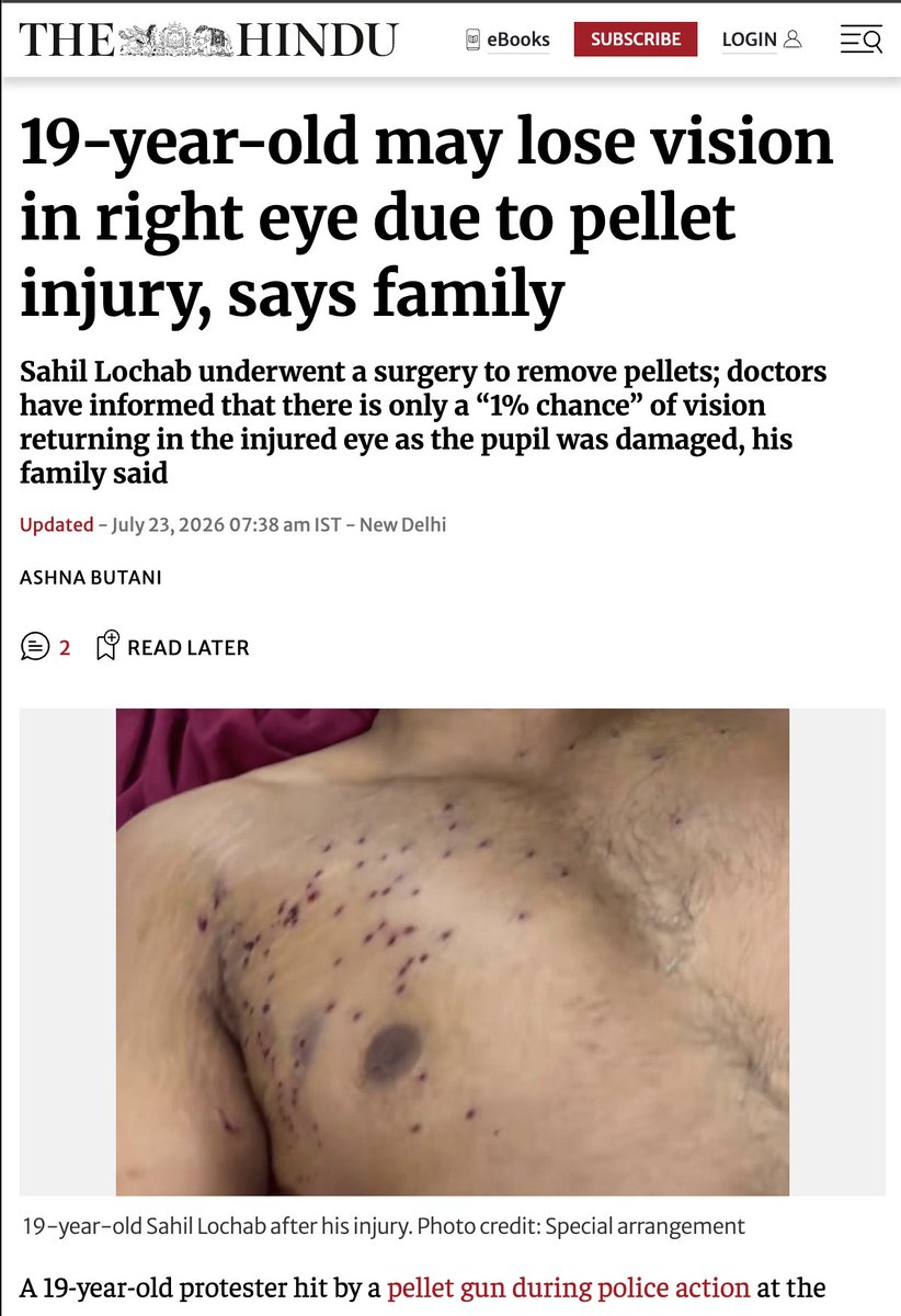 TheDeshBhakt's tweet photo. Dark days indeed for India.
@ajaydevgn's upcoming film 'Chauhan' described blinding injuries caused by pellet guns in Kashmir - as 'limited damage'. 
People cheered - another Dhurandar in the making! 
Now students in Delhi are seeing the devastating impact of pellet guns - RAF just brought the Kashmir experience into the MIDDLE of the national capital. 
Bootlicking sarkari trolls harassed @the_hindu's @vijaita after she tweeted the newsbreak. Asked her to delete this report - such depravity was hard to believe.
@DelhiPolice even cleverly issued an official denial (yes it was never the DP - it was RAF that fired - the report said it clearly - but RAF works under the command of DP)
Instead of backing down @ButaniAshna has now found ANOTHER victim of pellet gun injury...a 19 year old Sahil who now has 1% chance of regaining his right eye vision.
//
Atleast we can now say that the Modi Govt dosent discriminate between Kashmir and Delhi....