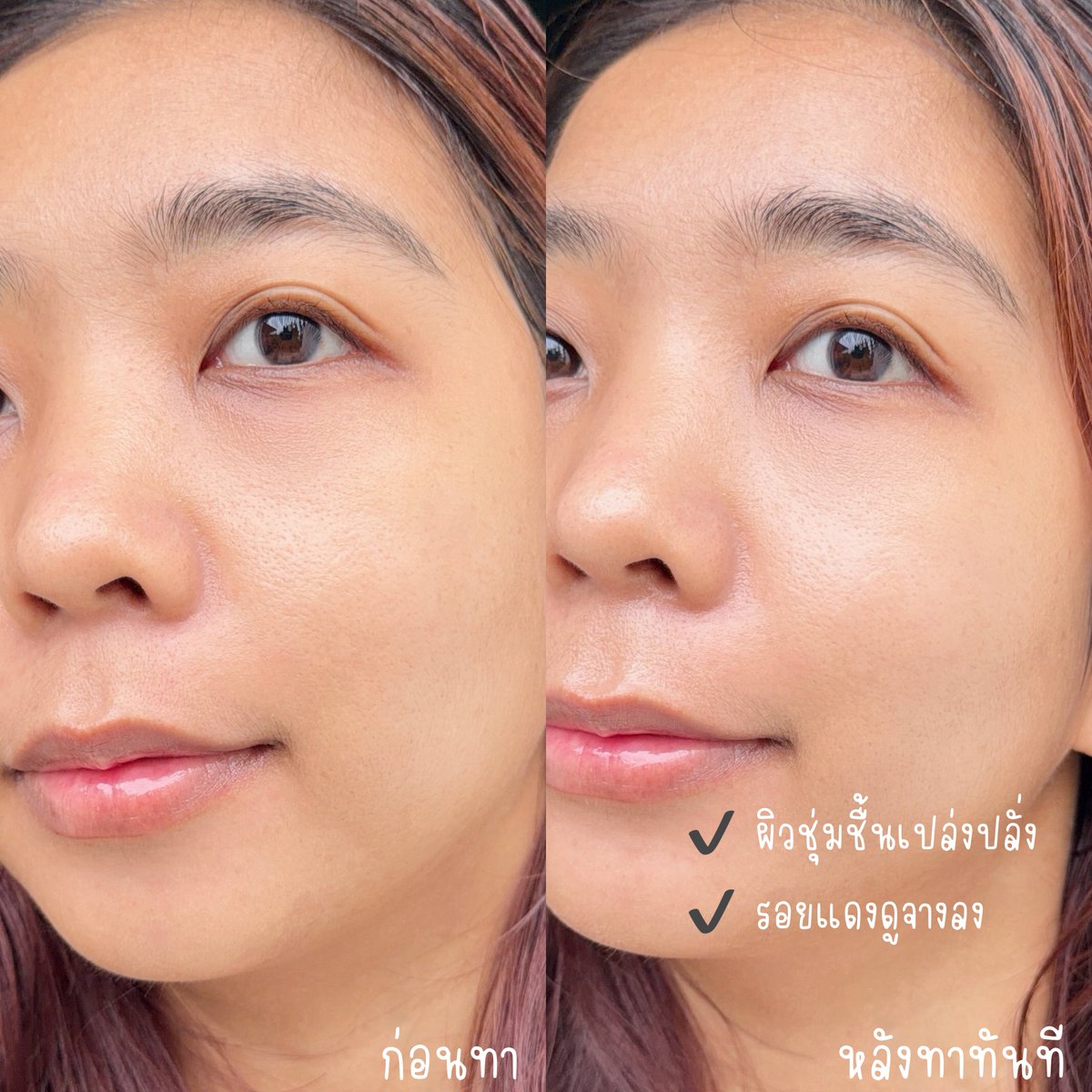 HoneyzBenya's tweet photo. ไอเทมกู้ผิวสตรองของคนผิวแพ้ง่าย d program Skin Repair Cream ครีมกู้ผิว เนื้อเบาสบาย ไม่อุดตัน ช่วยลดรอยแดง ปลอบประโลมผิวชั่วข้ามคืนให้ผิวกลับมาแข็งแรงขึ้นใน 3 วัน ผิวดูเรียบเนียนกระจ่างใสขึ้น อ่อนโยนสุดๆ ไม่มีแอลกอฮอล์ น้ำหอม พาราเบน คู่ควรกับผิวบอบบางมากก
#dprogram #dprogramThailand
#เวชสำอางอันดับหนึ่งในญี่ปุ่น