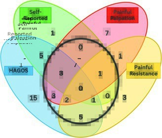 JOSPT's tweet photo. What is the prevalence of changes at the pubic symphysis in professional #female #football players 🤔
Our #ResearchReport looks at active players, and includes analysis of skeletal maturation, bony changes & symptoms of #hip or #groin pain
➡️ https://t.co/3aeWZz7Bb7
#yourJOSPT https://t.co/roGHNWH0ZT
