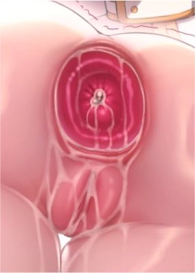PlanarcadiaIdol's tweet photo. @SuccubusAurelia ❝Guess you gotta pull it out...❞ 

Sparxie clicks a button and changes the camera to a rearview, as Aurelia pulls out her cock the Idol's ass prolapses and a small little rose flower forms. https://t.co/qW8tN9RtN4