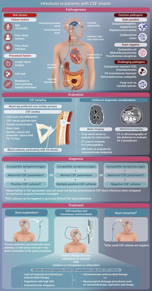 ABsteward's tweet photo. Wow, this is the review article I’ve been waiting for!
🆕🔥🟢State-of-the-Art Review: Infections in Patients With Cerebrospinal Fluid (CSF) Shunts #idxposts #bookmark https://t.co/63hVilBXlY https://t.co/SgALye8iQk
