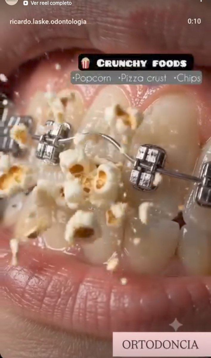 dg756's tweet photo. Le comento a mi dentista que comi pochoclos
Ella al segundo que se lo dije: https://t.co/ZM1MuY75ca