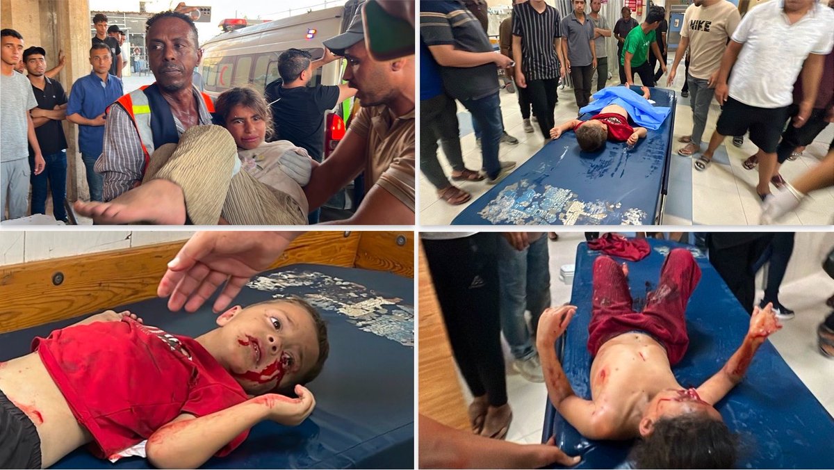 swilkinsonbc's tweet photo. The israelis have injured, terrorised and maimed multiple children bombing a family tent in Khan Yunis —some of the victims are critical https://t.co/yh1cpYAc9L