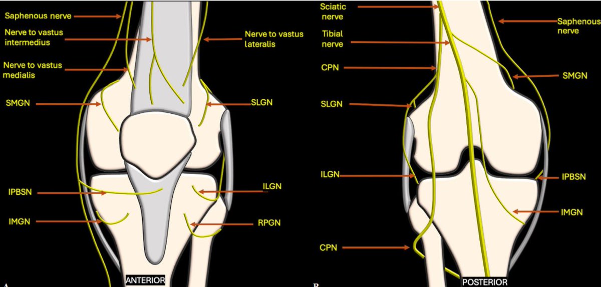 Rheumatology's tweet photo. Genicular nerves: ultrasound anatomy, scanning techniques, and clinical implications
FREE PDF
https://t.co/WOtO37AJZB https://t.co/naP1WCAOwN