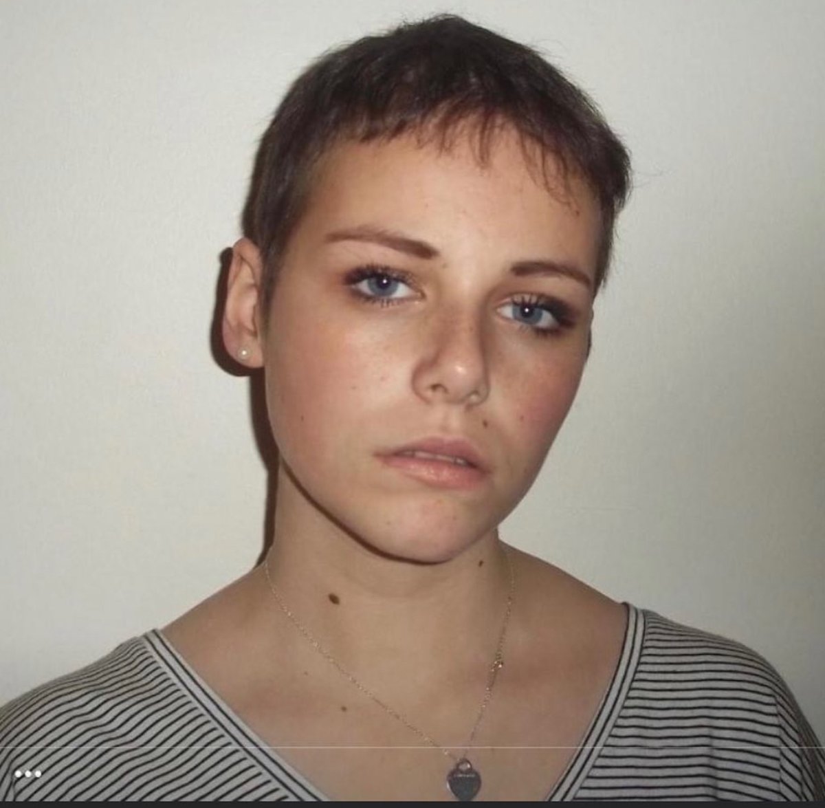 Charlotte's Battle Against Glioblastoma (BAG) tweet media