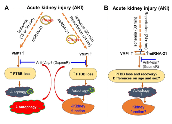 PhysiologicalG's tweet photo. Today's #ThrowbackThursday poses a very important question, Vacuole membrane #protein 1 and #miRNA-21: are they reliable partners to rescue acute kidney injury? (Utpal sen):
https://t.co/Zgks7vCPqK https://t.co/iHsSJtvfEI