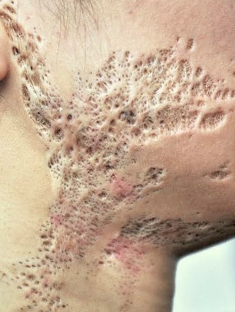DrMedica_13's tweet photo. Diagnose this skin lesions?

🥀❤️🥀 https://t.co/5pkiaBvS4M