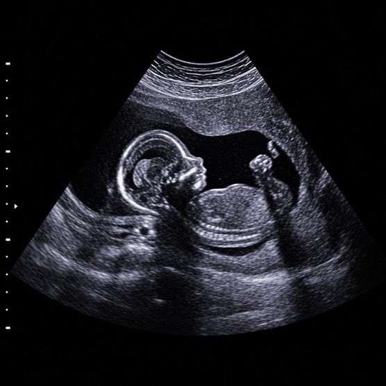 CultureCave_'s tweet photo. Kylie Jenner is pregnant with her first child with Timothée Chalamet. https://t.co/kElwCKJCFY