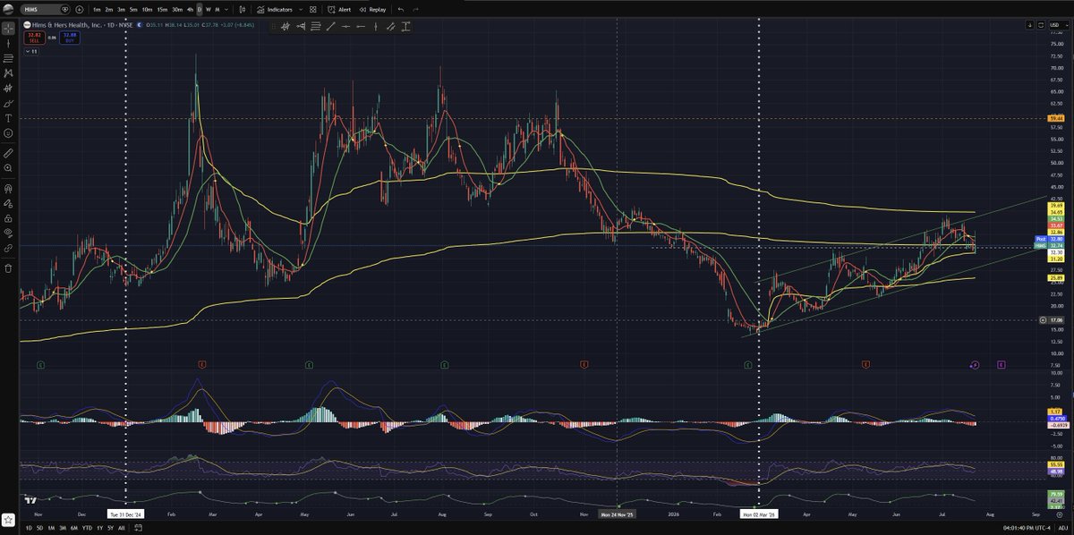 EasyMoneyJedi's tweet photo. $HIMS Apparently started getting high on its own supply or smoking crack or both on New Years Day 2025 and it appears to have entered rehab around March 2nd, 2026. Hopefully it doesn't relapse on 8-10-26, its next earning party. More charts in my profile. https://t.co/HhIOT2VU2r