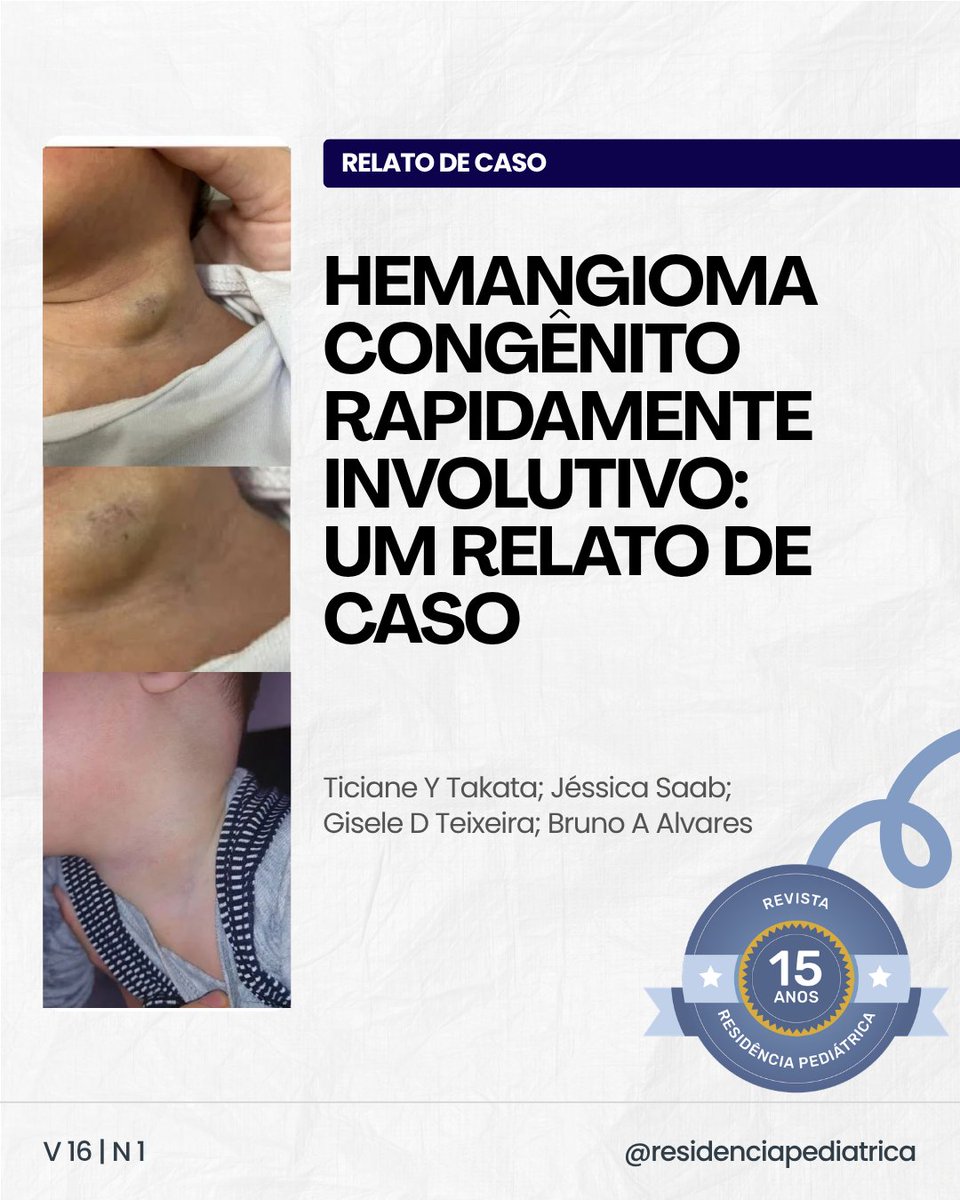 ResidPediatrica's tweet photo. Novo artigo publicado!

📝 Hemangioma congênito rapidamente involutivo: um relato de caso.

Confira o artigo completo acessando a revista Residência Pediátrica, volume 16, número 1 (https://t.co/VxmBUW0wbE).

#Hemangioma #Anormalidadescongênitas #Pediatria #Dermatologia https://t.co/8yO8H4XURE