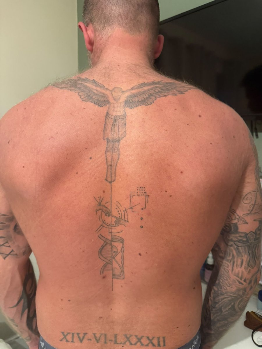 K3nn3dy10's tweet photo. So yesterday I was run over by a colleague at work and now facing a task of being unable to do my daily routine I’ve got a shoulder blade fracture and sciatic nerve damage gonna be a difficult few weeks ahead #Injury #recoverycrew #mentalhealth #mentalchallenge https://t.co/pPp3DUDt1T