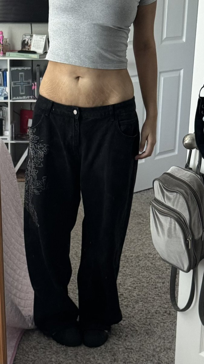 gyutlks's tweet photo. does anybody have tips of how to lighten/get rid of stretch marks 😵‍💫
reminder to never get fat yall https://t.co/xBYFazXhyP
