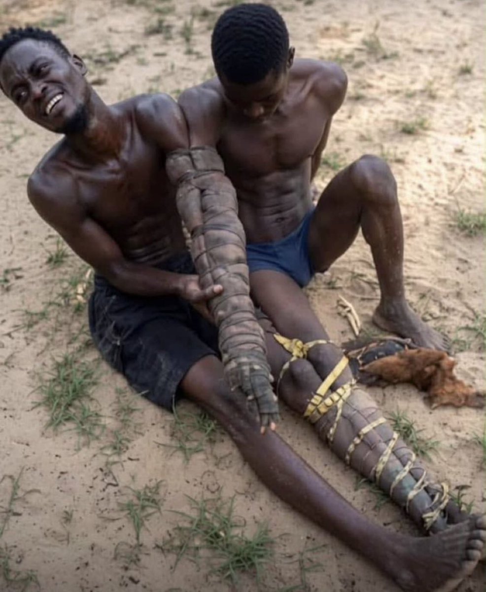Allezamani's tweet photo. This is an inhumane way to punish a petty thief, their hands are going to end up being amputated. Politicians steal billions and get worshiped by the same people they’re stealing away their future. 
What an irony of life. https://t.co/1FYSsxdJrU