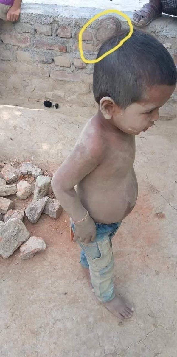 REAL___HINDUVT's tweet photo. मुझे यह नहीं मालूम है कि यह बच्चें किसी विद्यालय में जाते हैं या नहीं जाते हैं , किसी मन्दिर या धार्मिक स्थल पर जाकर प्रार्थना करते हैं या नहीं , इनके माता-पिता के पास कितना धन है ,यह कितनी अंग्रेजी जानते हैं 
यह सब इसलिए कह रहा हूं क्योंकि सामान्य व्यक्ति की इतनी ही सोच होती है ,,
पर मैं अगर अपनी दृष्टि से बात करूं तो मुझे यह 

बच्चे पढ़े लिखों पर भी भारी दिखाई पड़ रहे हैं,,
सभ्यता की जिन पहचानों को रखने में हम हिचकिचाहट महसूस करते हैं ,

ग्राम में वातावरण में आज भी सभ्यता के चिह्न आपको देखने में मिल जाते हैं अपने आपको ज्यादा पढ़ा लिखा मानने वाला व्यक्ति अपनी सभ्यताओं को प्राया पीछे छोड़ देता है ,,
अंग्रेजीयत को चाहने वाले अपनी सभ्यताओं में दोषदर्शन मात्र करते हैं ,जो खुद के लिए घातक है। छोटे बच्चों की शिखाएं मन को बहुत संतुष्ट करती हैं 🙏