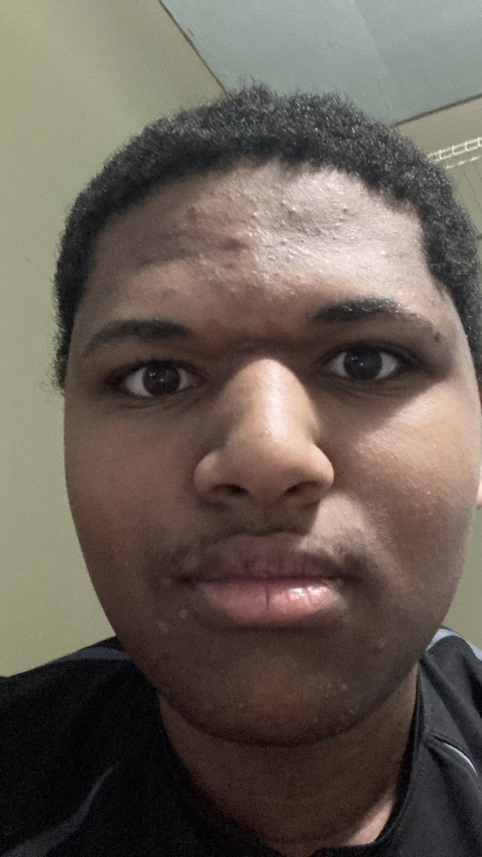 5XL Groyper🇬🇲🏳️‍🌈🏳️‍⚧️ tweet media