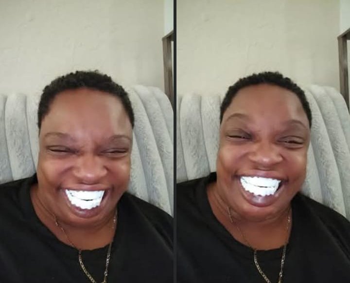kijana_misa's tweet photo. After years of people laughing at her and calling her teeth "meno karanga," she finally went to a cheap local dentist to whiten her brown teeth. 

Now look at what the dentist did!

Next time, she may have to smile with her mouth closed. https://t.co/aI6bsNEgnP