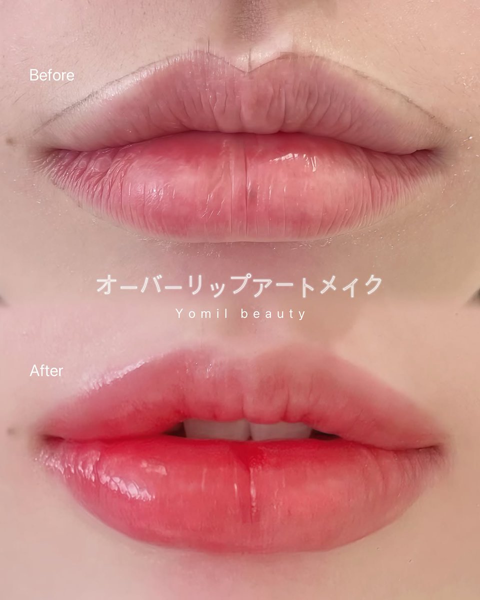 Yomil__artmake's tweet photo. 💋 韓国・江南リップアートメイク
毎日のリップメイクをもっとラクに✨
ヨミルでは、お客様一人ひとりのお顔立ちやご希望に合わせて、自然で美しい仕上がりをご提案いたします🤍

📍韓国・ソウル 江南
💌ご予約・お問い合わせ：LINE @yomil.

 #江南アートメイク #渡韓美容 #韓国美容 #リップメイク https://t.co/387JrOy05i