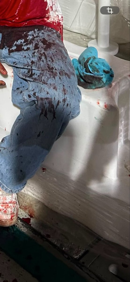 hnnhzdn's tweet photo. #gokart #gokartaccident #gokartracing
my friend was the one yang saw his entire scalp tercabut, helmet tergolek. MIND YOU HIS SKULL WAS EXPOSED. she saw everything happened dekat spectators view sbb tak main, and nak ambik gambar diaorg. my friend lari dekat dia masa staff dh - https://t.co/IlZ8bEWGa9