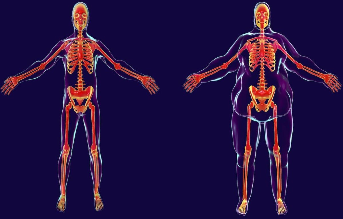 MemoriaHabil's tweet photo. 🤔 La grasa abdominal no es solo una cuestión estética.
Puede aumentar el riesgo de cáncer, diabetes y problemas cardíacos… y aun así, perderla parece imposible.
La buena noticia: con acciones simples y sostenibles, se puede lograr.
Aquí van 10 consejos prácticos 👇 https://t.co/S7fIoEcCbr