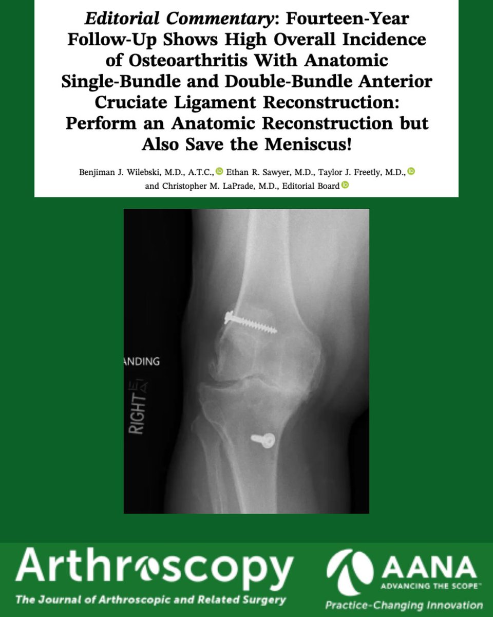 ArthroscopyJ's tweet photo. Anatomic ACL reconstruction matters—but meniscal preservation may matter even more. Check out this editorial. @thekneedoc
https://t.co/rGgJAvRWqk
 #ACLReconstruction #MeniscalPreservation https://t.co/p0rOsUYYxv