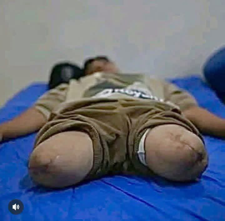 AhmedAAshour8's tweet photo. Entering one of Gaza’s hospitals may change your view of war forever; there you witness human suffering in its harshest form, beyond the numbers and headlines https://t.co/vFs1VAFRoQ