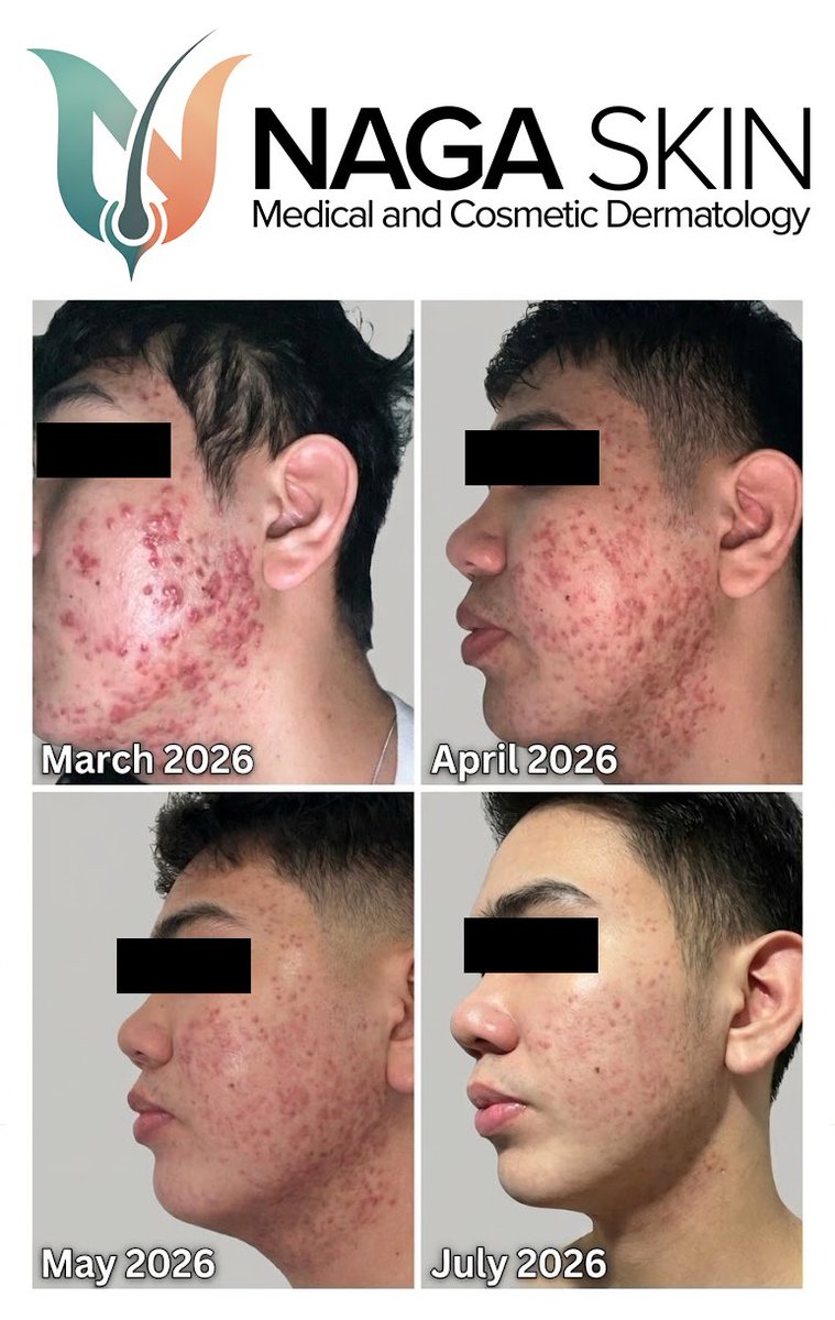 untoshible's tweet photo. Real skin. Real results. Trust the process.

📍 Book your consultation today.
https://t.co/yUSekSTGIY https://t.co/4NXdaqHgIe