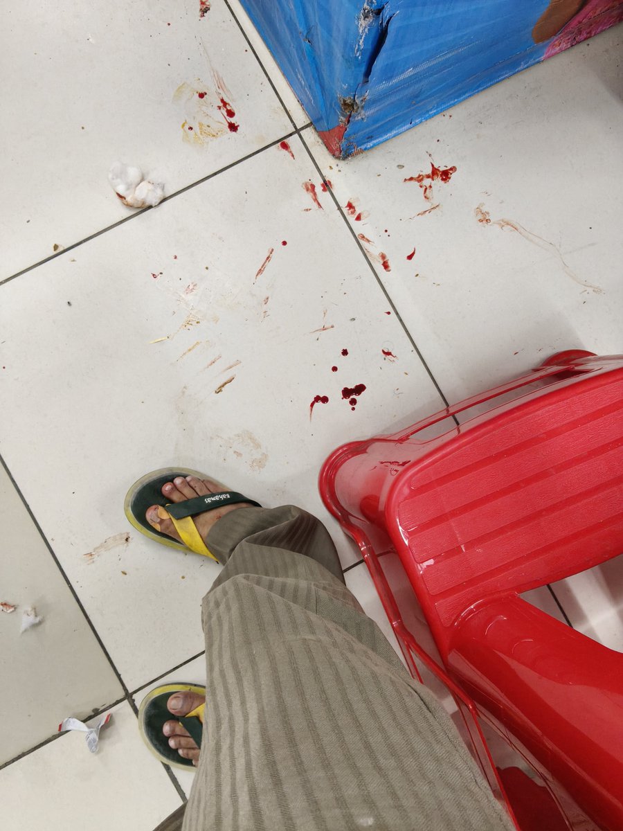 Kjha1982's tweet photo. 🚨 Shocking negligence at @RelianceRetail Faridabad today at 5:50PM. Stepped on broken glass left on the flr, injuring my foot. Instead of helping or providing 1st aid, the Store Mngr completely ignored me. Is this ur strd of customer sfty? @Ril #CustomerSafety #RelianceRetail https://t.co/JEdf9u2gRG