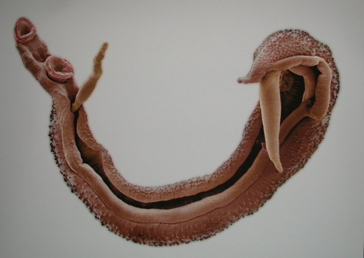 Ennan_D's tweet photo. The drug of choice for treating schistosomiasis is:

A. Albendazole
B. Metronidazole
C. Praziquantel
D. Ivermectin https://t.co/YTXMSIkBf1