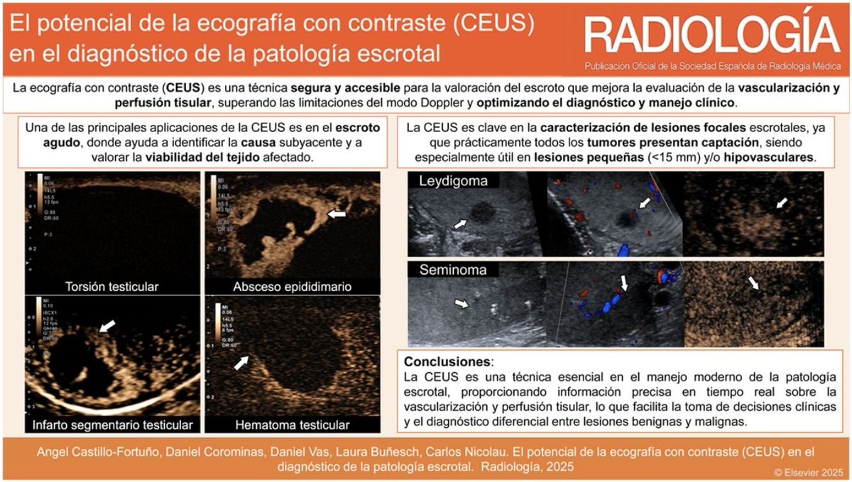 RevistaRADIOLO2's tweet photo. Descubre todas las aplicaciones de la ecografía con contraste en la patología escrotal en este interesante artículo de revisión @sediabdomen 
https://t.co/dQcv9hi9Ej
English: https://t.co/90JzMBTvS5 https://t.co/EXyfZoVFx0