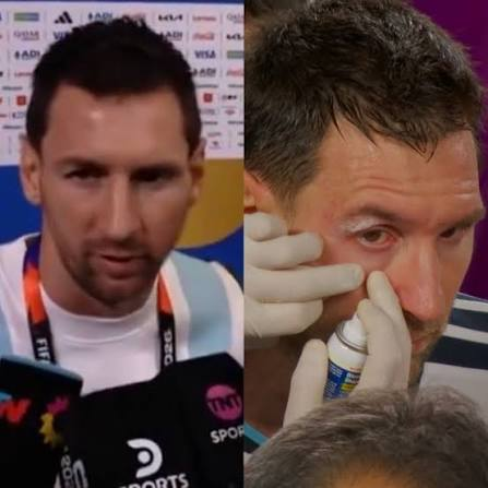 icardo8's tweet photo. El ojo de Messi se hinchó por el codo de Xhaka, pero no se tiró al suelo, no dramatizó la situación ni siquiera se quejó. Solo continuó con el partido como si nada  este es el tipo de tipo al que están tratando de demonizar.

https://t.co/p07OhMEyQ6 https://t.co/sajDLB1p9R