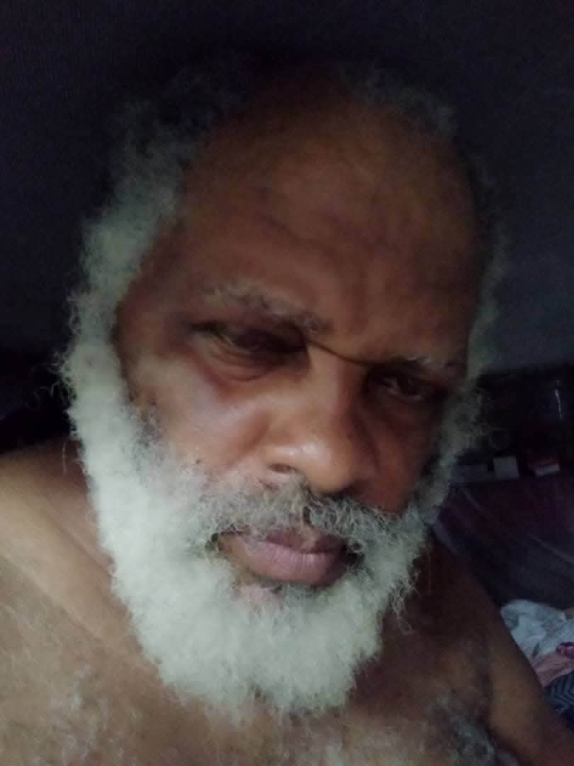 LeCremlin's tweet photo. -
Nom:  #AndréBlaiseEssama 🇨🇲
• Arrestation : 07/11/2025
• Motifs : Atteinte à la sûreté de l'État, fausses informations
• Situation : Détention provisoire (prison de New Bell), renvoyé devant le Tribunal militaire
• Durée : +8 mois (en attente de jugement, non condamné) https://t.co/bdY6P78qUs