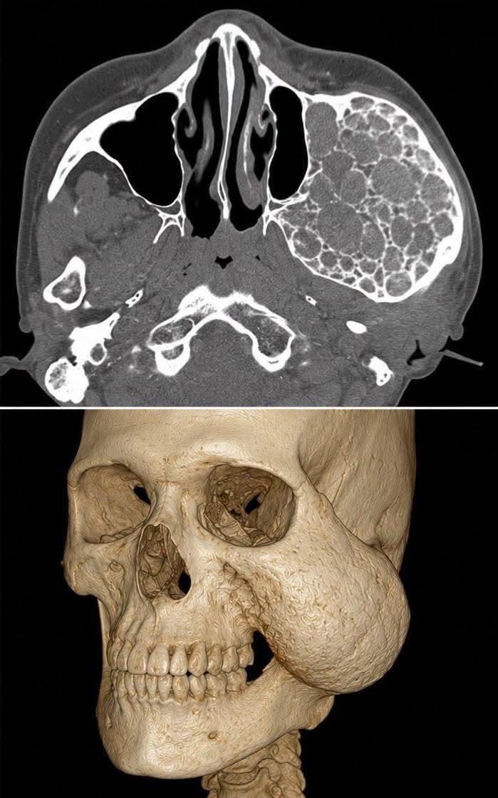 albertoortegana's tweet photo. What is the diagnosis⁉️ https://t.co/Jr82sgLcIZ