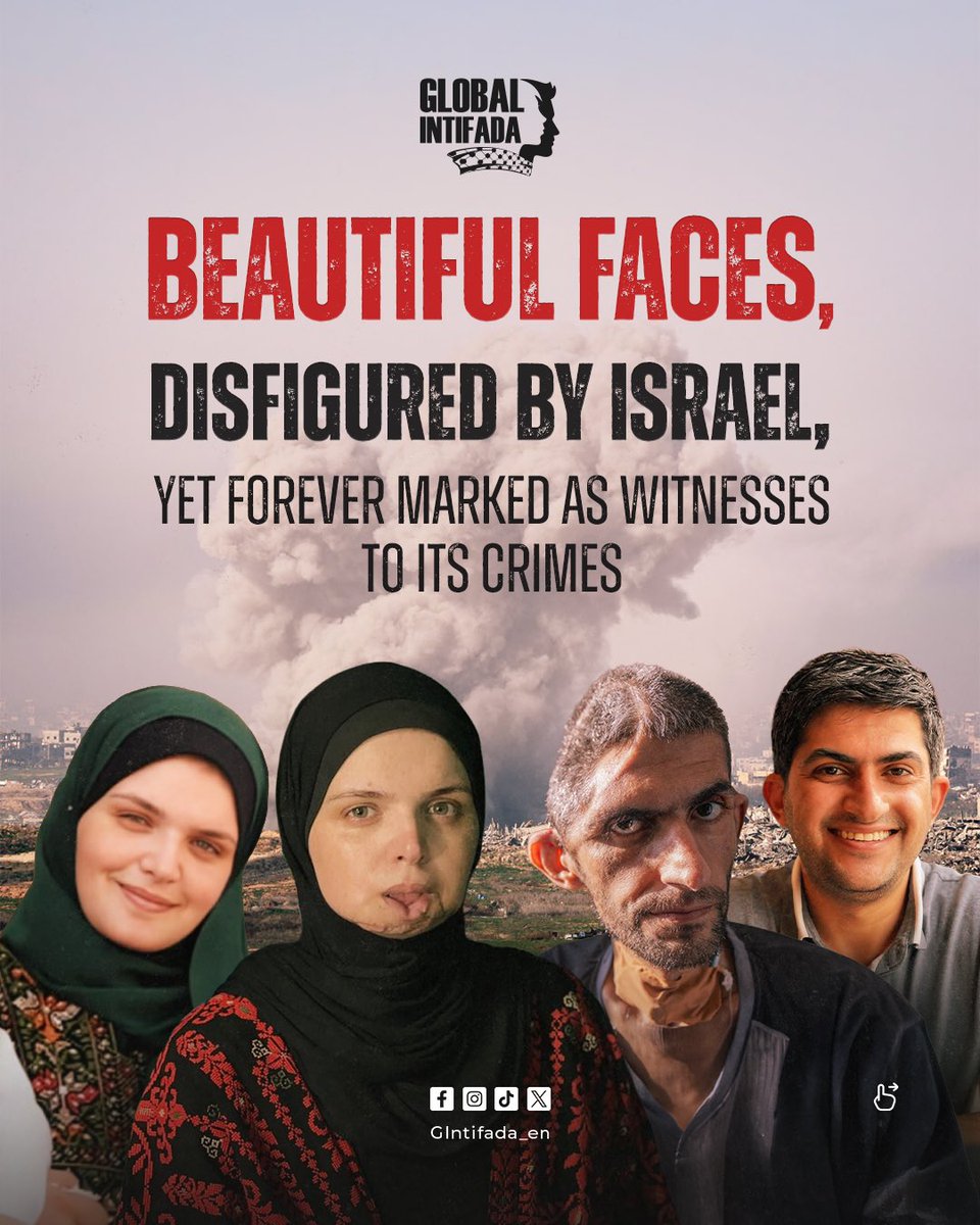 gintifada_en's tweet photo. These beautiful faces, disfigured by Israel, will forever stand as a testament not only to Israel’s brutality and cruelty, but also to the world’s complicity and indifference…! https://t.co/yzqVQ0skk5