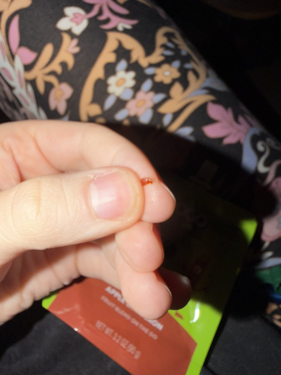 freealltitans's tweet photo. @GoGosqueeZ there was a plastic piece in my gogo squeeze :( https://t.co/kc7mZuzwCx