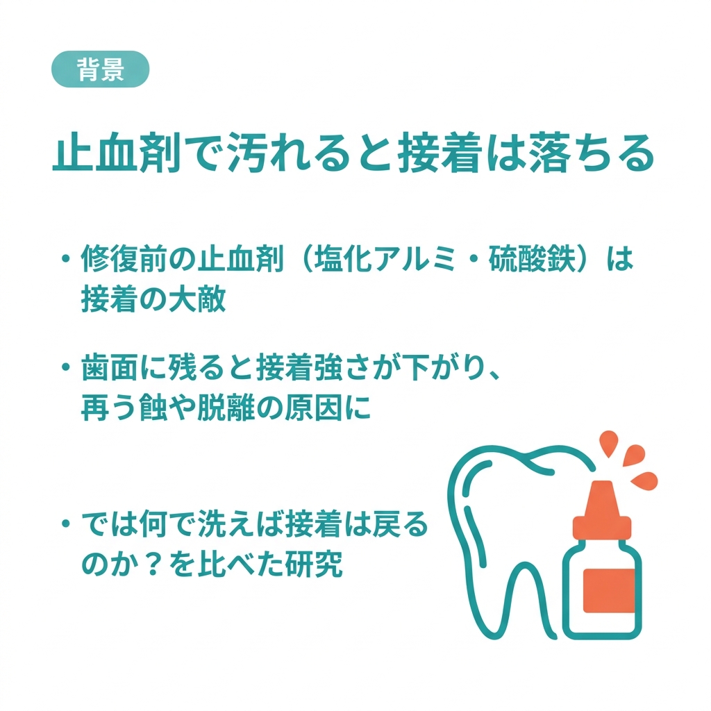 yuuta023's tweet photo. 論文解説
【止血剤で汚れた歯面、接着はあきらめる？】

支台歯形成のあとに止血剤を使い
水でサッと流して接着、はよくある流れです
でも止血剤の残りは接着の天敵で、戻りにくいのが理由です

ではどうするのがいいか？

【論文の内容📃】

止血剤で汚した象牙質を、4つの方法で洗って接着強さを比べたin vitro研究
水洗い／リン酸／クロルヘキシジン／カタナクリーナーの対決です

✅ 接着強さ（硫酸鉄汚染）：水洗い 9.1 → クロルヘキシジン 19.2 MPa まで回復・向上（未汚染基準は11.5）
✅ リン酸も 16.6 まで回復、リン酸とCHXは水洗いより有意に高い
✅ カタナクリーナーは 12.7 と伸びず、水洗いと統計的に変わらなかった

カギは、リン酸がレジンの通り道をひらき、CHXがコラーゲン分解酵素(MMP)を抑える点
「汚れを落とす」だけでなく接着を後押ししていた

【大原の一言📢】
しかしながら、リン酸が象牙質に当たることは接着力を落とす要因にもなりかねません。なのでそもそも硫酸鉄や塩化アルミニウムなどを使用しない方が安全。
僕はシュアーコードプラスなどの止血剤入りの圧排糸ではなく、シュアーコードクリーン＋ボスミン（接着阻害しない）を使用するようにしています。

【論文の限界😵】
ヒト抜去歯のin vitro・各群10個と少数で、象牙質・セメント1種のみの評価です
「カタナは象牙質ではダメ」と断じるのは行きすぎ、方向性として読むのが安全です

🔗 細かい結果の数字・仕組み・明日の臨床はブログで👇
https://t.co/mZ3M5Y0w7u

さらに動画解説と毎月のウェビナーで学びたい人はオンラインサロンへ
論文解説 見放題 ＋ 動画解説 ＋ 毎月ウェビナー
https://t.co/IfXsXDuwPU

#歯科 #歯科医師 #歯科衛生士 #歯科論文 #保存修復 #接着 #止血剤