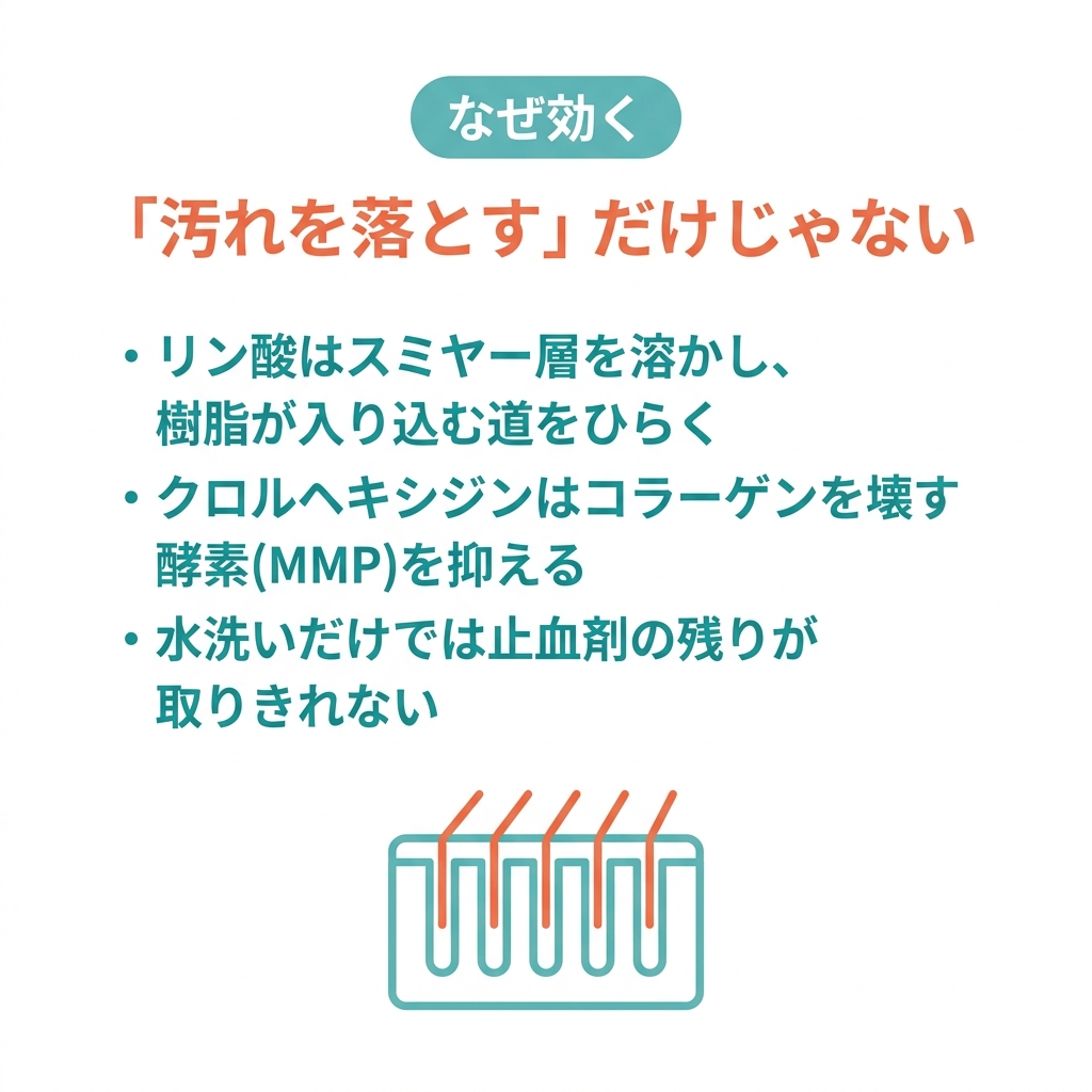 yuuta023's tweet photo. 論文解説
【止血剤で汚れた歯面、接着はあきらめる？】

支台歯形成のあとに止血剤を使い
水でサッと流して接着、はよくある流れです
でも止血剤の残りは接着の天敵で、戻りにくいのが理由です

ではどうするのがいいか？

【論文の内容📃】

止血剤で汚した象牙質を、4つの方法で洗って接着強さを比べたin vitro研究
水洗い／リン酸／クロルヘキシジン／カタナクリーナーの対決です

✅ 接着強さ（硫酸鉄汚染）：水洗い 9.1 → クロルヘキシジン 19.2 MPa まで回復・向上（未汚染基準は11.5）
✅ リン酸も 16.6 まで回復、リン酸とCHXは水洗いより有意に高い
✅ カタナクリーナーは 12.7 と伸びず、水洗いと統計的に変わらなかった

カギは、リン酸がレジンの通り道をひらき、CHXがコラーゲン分解酵素(MMP)を抑える点
「汚れを落とす」だけでなく接着を後押ししていた

【大原の一言📢】
しかしながら、リン酸が象牙質に当たることは接着力を落とす要因にもなりかねません。なのでそもそも硫酸鉄や塩化アルミニウムなどを使用しない方が安全。
僕はシュアーコードプラスなどの止血剤入りの圧排糸ではなく、シュアーコードクリーン＋ボスミン（接着阻害しない）を使用するようにしています。

【論文の限界😵】
ヒト抜去歯のin vitro・各群10個と少数で、象牙質・セメント1種のみの評価です
「カタナは象牙質ではダメ」と断じるのは行きすぎ、方向性として読むのが安全です

🔗 細かい結果の数字・仕組み・明日の臨床はブログで👇
https://t.co/mZ3M5Y0w7u

さらに動画解説と毎月のウェビナーで学びたい人はオンラインサロンへ
論文解説 見放題 ＋ 動画解説 ＋ 毎月ウェビナー
https://t.co/IfXsXDuwPU

#歯科 #歯科医師 #歯科衛生士 #歯科論文 #保存修復 #接着 #止血剤