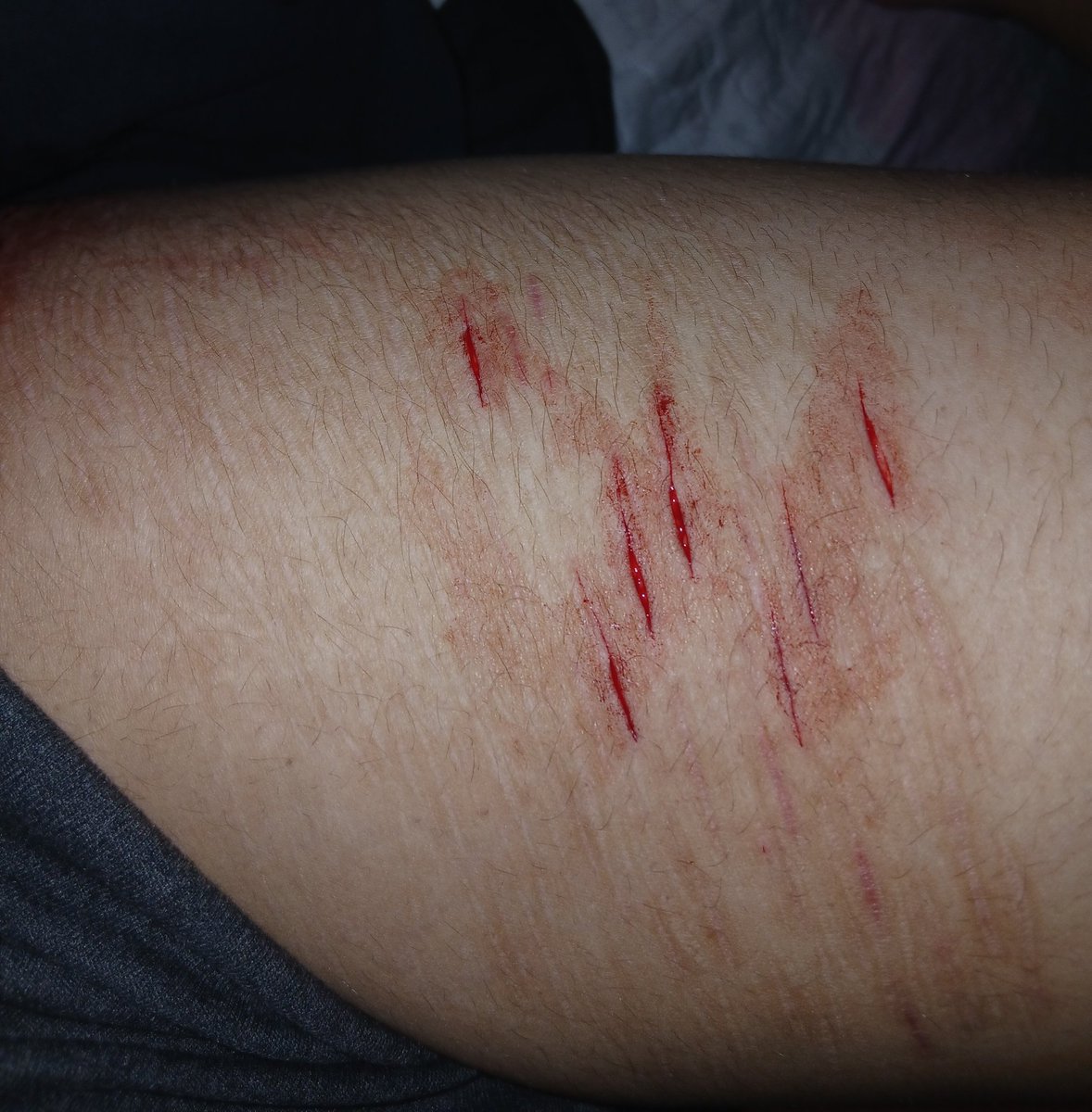 Erwin0_o's tweet photo. All styros
.
.
.
ALL FAKE SFX MAKEUP https://t.co/zEukxDLSLM