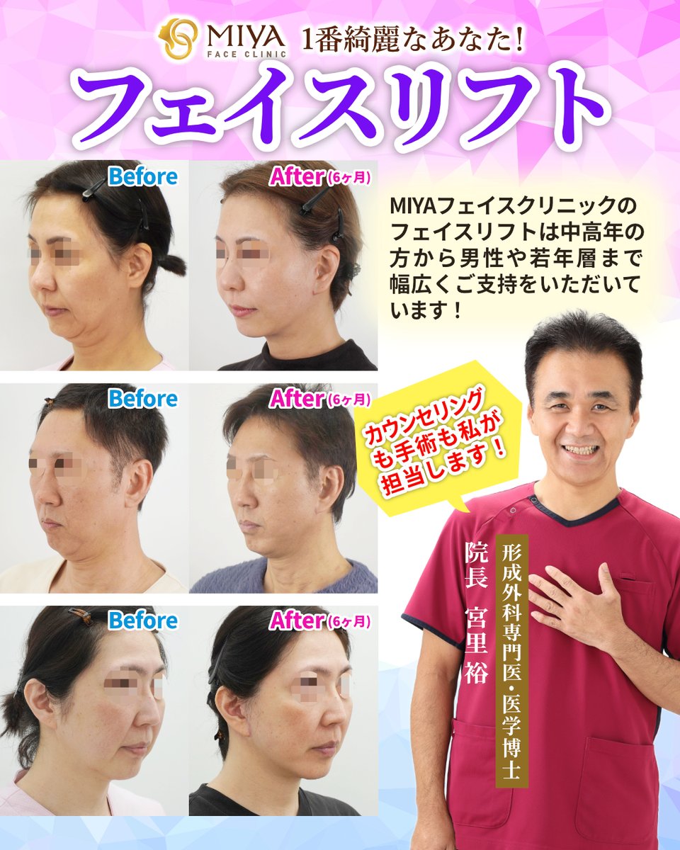 MIYAfaceclinic's tweet photo. 提携ホテル完備・全国対応のフェイスリフト専門クリニック。
◆MIYAフェイスクリニック

【自然な若返りを、本気で目指す。】

10年後も「受けてよかった」と思っていただくために。 遠方の方もご相談ください。

#1番綺麗なあなた #美容外科 #フェイスリフト https://t.co/M3i827mg5P
