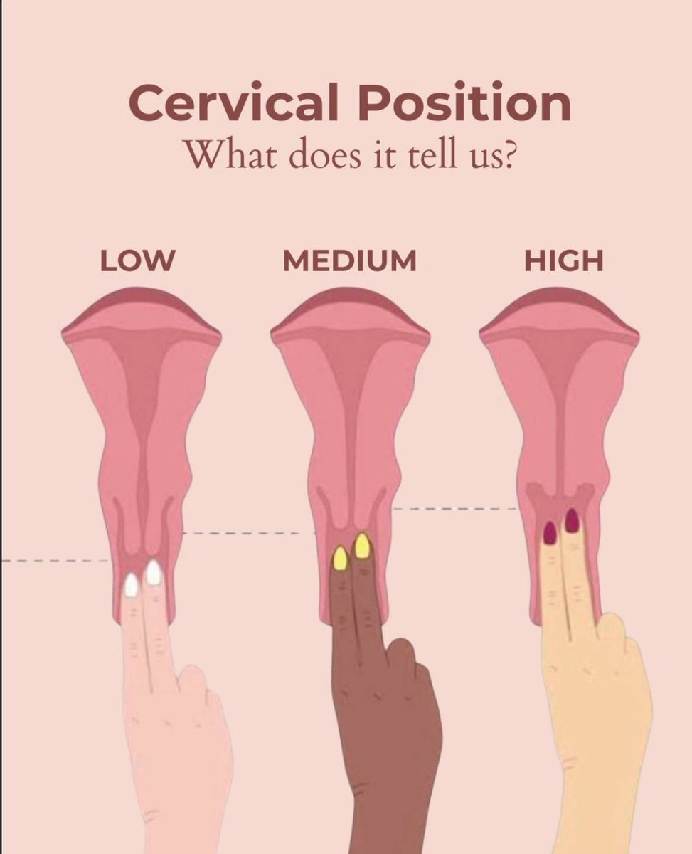 Medicalp0sts's tweet photo. Cervical Position https://t.co/hOtamxyXTV