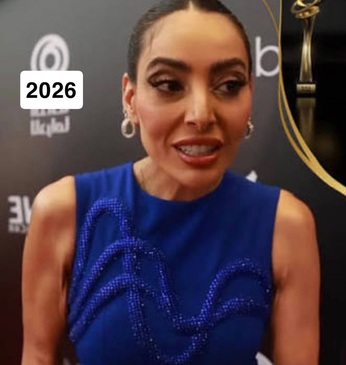 QioHub's tweet photo. متداول:

فاطمة الصفي بعد مرور 10 سنوات 😰 https://t.co/s4EBT0uCJD